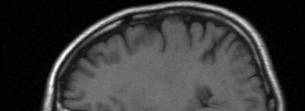 MRIBrainScan